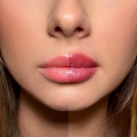 NAM Nawilżający i powiększający błyszczyk do ust Lip Volume